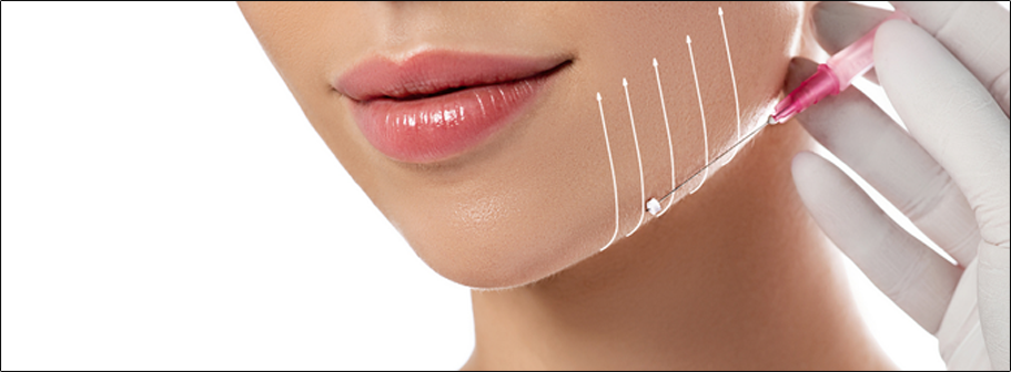 No Dimple Thread Lift Mississauga Oakville Toronto