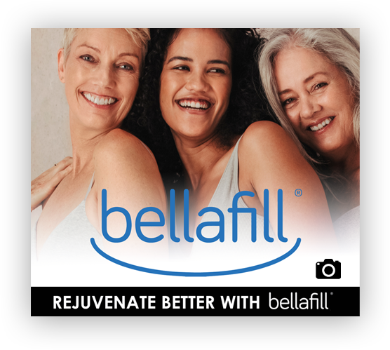 bellafill treatments long lasting volume enhanced confidence