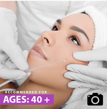 cheek enhancement fillers results before after mississauga oakville