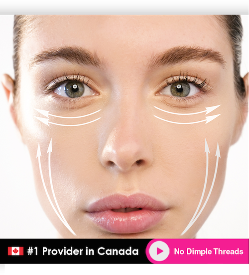 no dimple threads face lift mississauga oakville toronto
