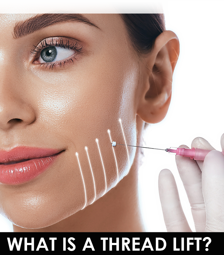what is a thread lift mississauga oakville toronto