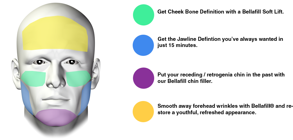 re shape your face with bellafill