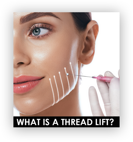 thread lift rejuvenation treatment before after mississauga oakville